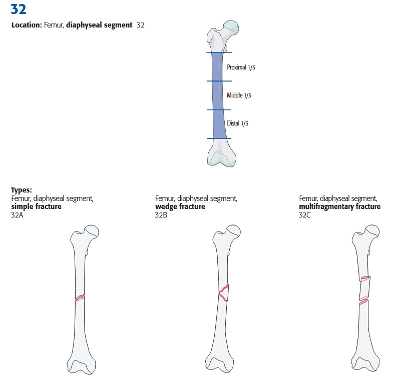 femur_diaphyse