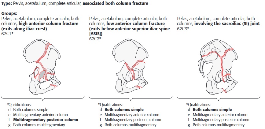 acetabulum_ao_C